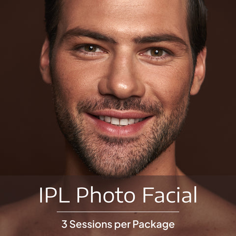 Elite IPL Photo Facial
