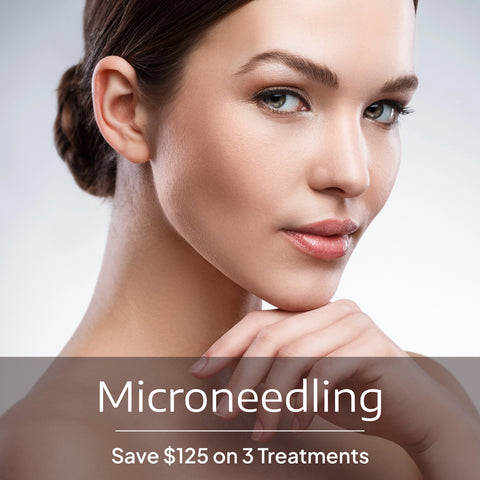 Elite Microneedling Treatments (Pkg of 3)
